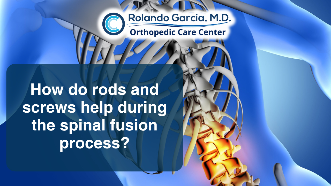 How do rods and screws help during the spinal fusion process?
