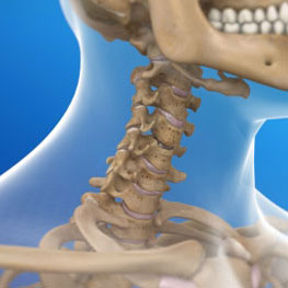cervical-total-disc-replacement-sq